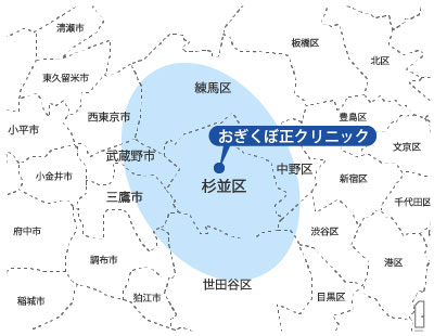 訪問エリアの地図イラスト